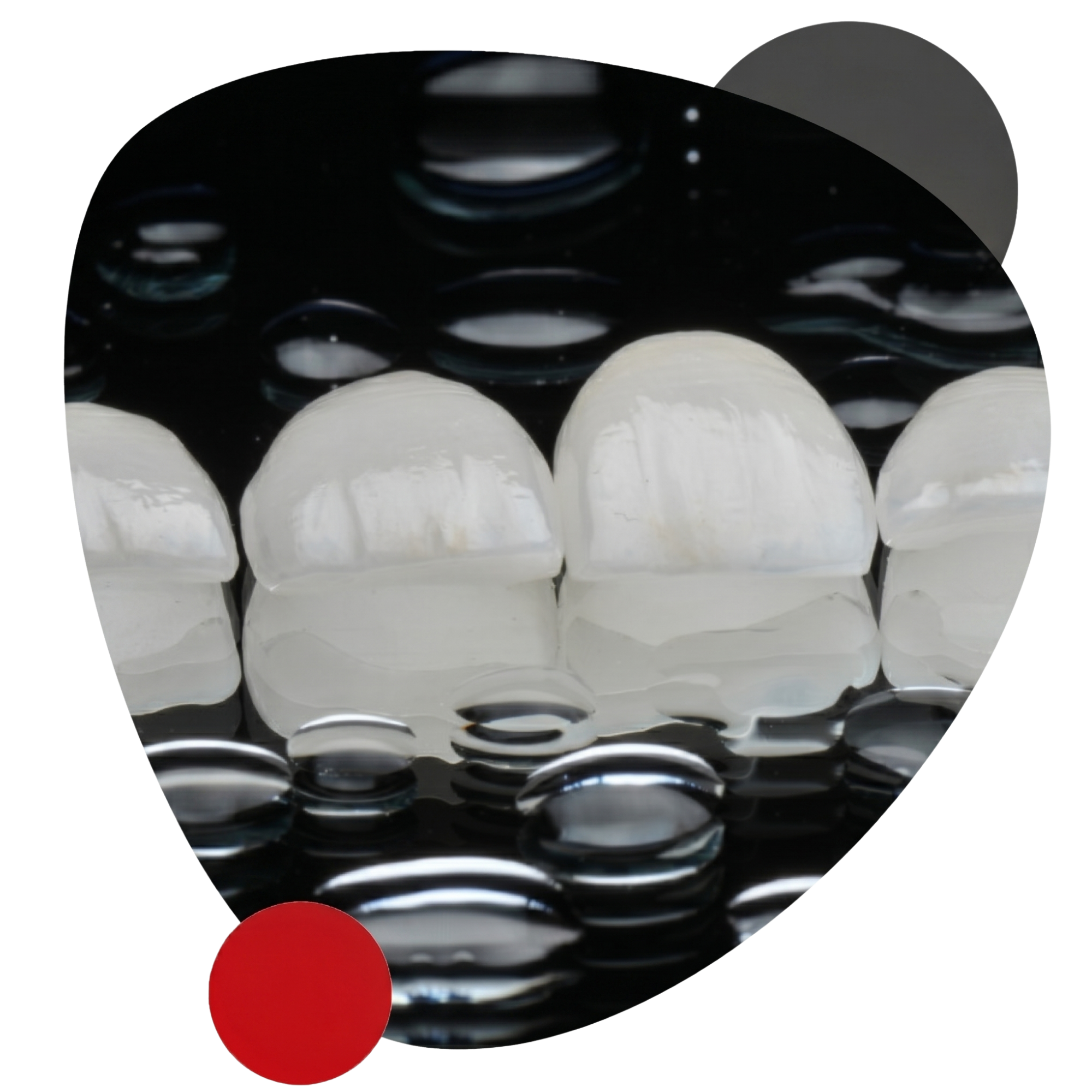 Lentes de Contato Dental
